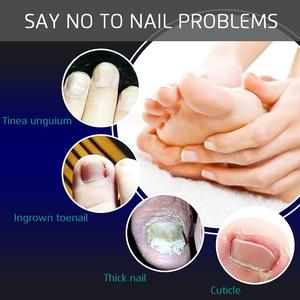 Alicates para uñas, mandíbula plana de corte recto, 11,5 cm, cortaúñas afiladas, cortadores de uñas de los pies, podólogos duraderos PROFESIONALES DE ACERO INOXIDABLE - Product Image 4