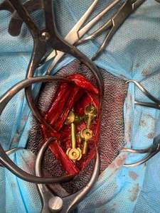 Prix usine Vet TTA Kit d'instruments rapides avec implant Instruments chirurgicaux vétérinaires avec plaque TTA et vis pour vétérinaire - Product Image 4