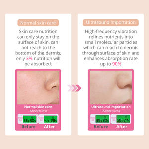 ダイヤモンド皮膚剥離マイクロ皮膚剥離ブラックヘッド除去真空孔洗浄機MS-33P3 - Product Image 4