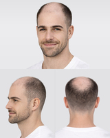 Sistema de Reemplazo Capilar Humano Pre-estilizado Listo para Usar, Prótesis Masculina con 4 Tipos de Base, Toupee para Hombres