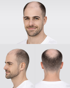 Prothèse capillaire prête à porter pour hommes, système de remplacement capillaire en cheveux naturels, 4 types de bases, toupet pour hommes - Product Image 3