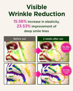 Soins de la peau coréens Produits de beauté Anti-âge Produits anti-rides Sérum visage CKD Rétinol Collagène Guasha Sérum lifting 40ml - Product Image 4