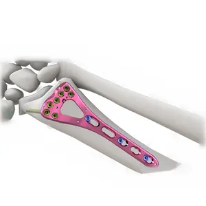 Piastra ossea ad alta resistenza in puro titanio impianti ortopedici sinistro e destro piastre di bloccaggio L-metacarpale