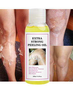 Wholesale Extra Strength Yellow Peeling <strong>Oil</strong> for <strong>Face</strong> and Body Skin Whitening Dark Scars Spots <strong>Remover</strong> for Black Skin - Product Image 2