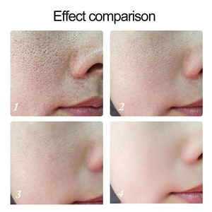 Niacinome เซรั่มบำรุงผิวสำหรับต่อต้านริ้วรอยขวด100มล. เซรั่มความงามแบบมืออาชีพสำหรับเซรั่มผิวทุกประเภท - Product Image 3