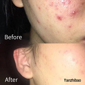 Limpiador Facial <span class=keywords><strong>Astringente</strong></span> Original OEM con Aroma Fresco, Ingredientes a Base de Agua, Hidrata y Previene la Resequedad - Product Image 4