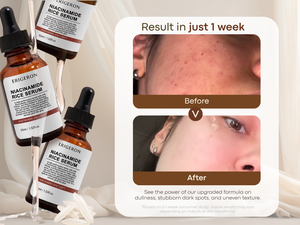 Sérum à l'extrait de riz Bifida et à la niacinamide pour une peau éclatante et une texture affinée, marque privée - Product Image 4