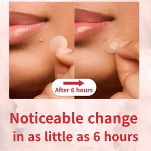 Korean Hydrocolloid Acne Healing Patch OEM Private Label Invisible Zit Spot <b>Sticker</b> Wholesale Supply - Product Image 2