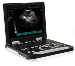 Equipo <span class=keywords><strong>de</strong></span> Diagnóstico Veterinario, Equipo <span class=keywords><strong>de</strong></span> Ultrasonido Médico, Máquina <span class=keywords><strong>de</strong></span> Ultrasonido Veterinaria Portátil - Product Image 4