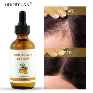 น้ำมันขิงธรรมชาติสำหรับปลูกผม7วันน้ำมันสำหรับปลูกผมน้ำมัน Batana - Product Image 4