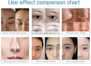 เครื่องไฮโดรเดอร์มาเบรชั่น 16 in 1 สำหรับฟื้นฟูผิวหน้า ทำความสะอาดผิวหน้า เครื่องเสริมความงาม ไดมอนด์ไมโครเดอร์มาเบรชั่น กระชับรูขุมขน บำรุงผิว - Product Image 6