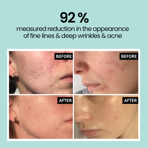 Mascarilla exfoliante personalizada, antiedad, antiacné, ácido glicólico, tóner <span class=keywords><strong>Facial</strong></span>, Etiqueta Privada, Oem de fábrica - Product Image 4