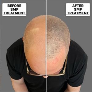 Tinta de Tatuaje SMP Recién Llegada, 10 ml, Pigmento de Micropigmentación Capilar para Tatuajes de Línea Capilar, Ideal para Uso en Estudios y Academias - Product Image 5