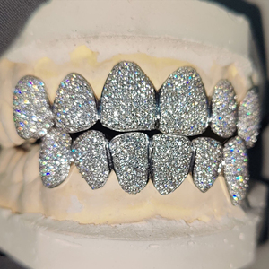 Grillz en argent entièrement glacé personnalisé serti de diamants moissanite VVS1 pour dents supérieures et inférieures Grills Bling de luxe - Product Image 2