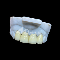 Couronne en zircone de porcelaine E-max à externaliser |   Restaurations dentaires de précision avec technologie E-max et zircone
