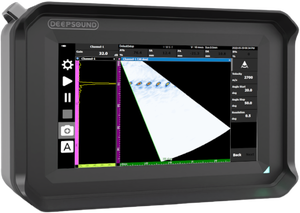DEEPSOUND B1 Sistema PAUT portátil inteligente DSViewer Compatible Opcional IP65 1 año de garantía ODM Hecho en Corea - Product Image 3