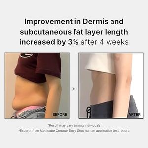 เครื่องนวดยกคอใบหน้าแบบเกาหลีขนาด140กรัมอุปกรณ์ความงามแบบมือถือ AGE-R ใช้นวดยกคอแบบร้อนแรงสำหรับ Medicube - Product Image 3