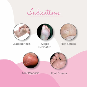 Crème pour les pieds Footvital au beurre de kokum hydratant pour peaux sèches prête à être expédiée par les exportateurs indiens-50g - Product Image 5