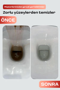 Bathroom <b>Cleaner</b> for Limescale, Rust & Odor Remo 750ml WC-Gel Anti-Rust <b>Acid</b> <b>Toilet</b> <b>Cleaner</b> - Product Image 4