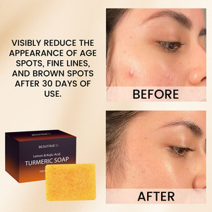Approvisionnement d'usine Curcuma <span class=keywords><strong>Savon</strong></span> à l'acide kojique Barre de beauté éclaircissante biologique Teint radieux Doux Nettoyant Hydratant Soins de la <span class=keywords><strong>peau</strong></span> - Product Image 2