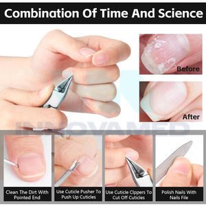 Cortaúñas Curvos de Acero Inoxidable de Alta Calidad con Amplia Apertura de Mandíbula - Herramientas de Cuidado de Uñas para Dedos de Manos y Pies - Product Image 6