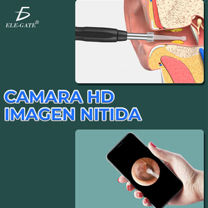 Pulitore Auricolare Smart con WiFi e Telecamera, Rimuovi Cerume in Acciaio Inossidabile e Plastica, Endoscopio per Uso Domestico, Compatibile con Spine USA e CN - Product Image 5