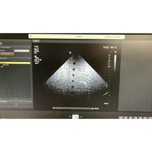 Nuevo transductor/sonda cardíaca compacta para adultos CX S4-2, compatible con OEM/ODM para Affiniti/Sparq/CX30 - Product Image 4