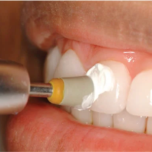 25um пластинчатая пластина из оксида алюминия в форме мелкодисперсного порошка для зубной пасты - Product Image 2