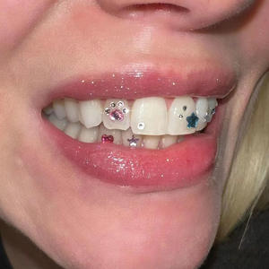 Gemme dentarie di cristallo ornamento di diamante di varie forme colore denti gioielli dentiera in acrilico decorazione denti gemma del dente - Product Image 3