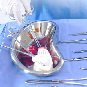 Meilleures ventes : Coupelles rénales manuelles en acier inoxydable, instruments chirurgicaux réutilisables, qualité A+, certifiés CE, pour usage en chirurgie générale, faible MOQ - Product Image 5