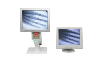 Unit <span class=keywords><strong>X-Ray</strong></span> <span class=keywords><strong>Mini</strong></span> Peralatan Diagnostik <span class=keywords><strong>X-Ray</strong></span> Hewan Mesin <span class=keywords><strong>X-Ray</strong></span> Portabel Genggam untuk Podiatri - Product Image 4