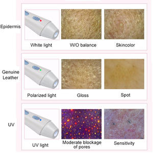 गर्म पोर्टेबल 1280x960 रिज़ॉल्यूशन 80x वायरलेस वाईफाई ip53 रेटेड एलसीडी डिस्प्ले डिजिटल माइक्रोस्कोप त्वचा विश्लेषण के लिए संगत - Product Image 3