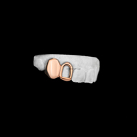 Custom Gold Solid Cap & Open Face Combo Único Hip Hop Diseño Tooth Grillz para los dientes superiores Boquilla de 2 dientes