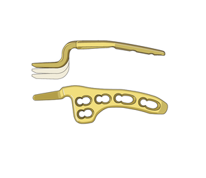 Renix International 2025 édition titane acier inoxydable 3.5 MM clavicule crochet manuel Source d'alimentation Instrument chirurgical base - Product Image 1