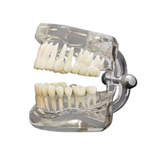 Hotseller NieuwBeijing TIANLIAN Transparant Anatomisch Tandmodel Prothese Implantaat Pathologisch Displaymodel - Product Image 5