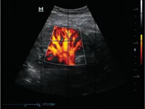Listo para envío: Ecógrafo Mindray DP50 con sonda a elegir y 3 años de garantía - Product Image 2