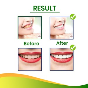 Cepillo de dientes natural de Miswak sellado al vacío con sabor natural para una goma de mascar saludable a un precio asequible de la India. - Product Image 5