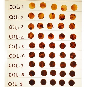 Bulk ox horn color button blanks for shirt coat jacket tailoring <b>accessories</b> sustainable horn material supplier supply chain - Product Image 6