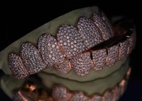 Rejilla Dental Personalizada de Oro Rosa con Diamantes Incrustados para Dientes Superiores e Inferiores, Piedras Simuladas VVS1, Joyería Hip Hop para la Boca