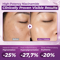 Sérum Visage Éclaircissant et Anti-Taches à 20% de Niacinamide, Glutathion et Acide Tranexamique pour Peaux Sensibles – Marque Blanche