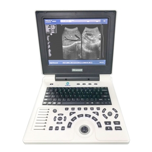 Escáner <span class=keywords><strong>Doppler</strong></span> <span class=keywords><strong>de</strong></span> Ultrasonido Portátil Veterinario a Color para Animales Grandes, Máquina <span class=keywords><strong>de</strong></span> Ultrasonido Portátil para Cabras - Product Image 2