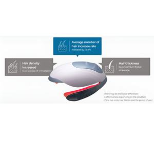 ผมร่วงป้องกันการเจริญเติบโตของเส้นผมด้วยไฟ LED และการฉายรังสีเลเซอร์ - Product Image 2