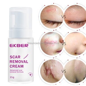 Marque privée Crème réparatrice anti-<span class=keywords><strong>vergeture</strong></span> pour enlever les cicatrices d'acné Crème forte et efficace pour enlever les cicatrices - Product Image 3