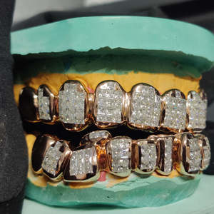 Ensemble de grillz personnalisé en or rose entièrement serti de diamants de style hip-hop avec diamants taille princesse pour les dents supérieures et inférieures - Product Image 4