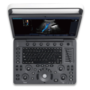 SonoScape E2 ProV Sistema de Ultrasonido Doppler Color Veterinario Portátil con Una Sonda, Escáner de Ultrasonido E2 Pro, Precio de Distribuidor - Product Image 3