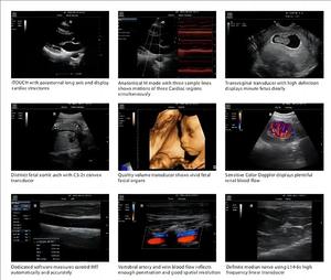 <span class=keywords><strong>Mindray</strong></span> <span class=keywords><strong>M5</strong></span> медицинский ультразвуковой аппарат/портативный ультразвуковой сканер цена - Product Image 5