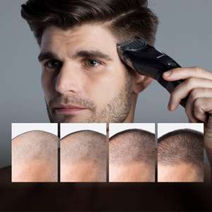 Recortadora de Cabello Negra Lavable, 19 Longitudes de Corte Ajustables (1-10 mm), Cuchilla de Acero Inoxidable, Fuente de Alimentación Eléctrica, IPX7, Francés, Estadounidense - Product Image 6