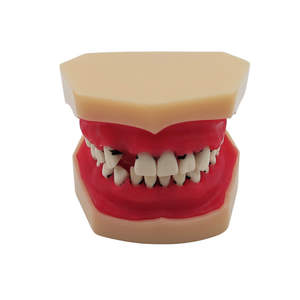 Modelo Educativo de Enseñanza Dental, Modelo de Enfermedad Periodontal - Product Image 2