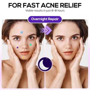 맞춤형 핑크 하트 모양 하이드로콜로이드 여드름 패치 치료 얼굴 피부 스팟 여드름 패치 스킨케어용 - Product Image 5