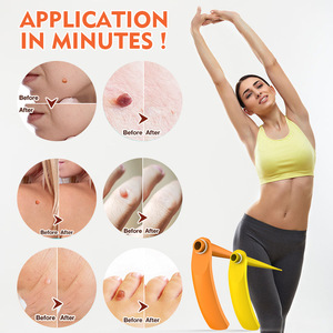 Bộ dụng cụ loại bỏ thẻ da điều trị dụng cụ làm sạch da Micro Band 2-8mm cho mụn cóc berrugas loại bỏ mụn cóc nốt ruồi chăm sóc mặt - Product Image 3